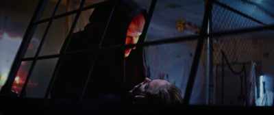 And I didn't - Extremity