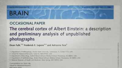 And I think tom would've felt
vindicated for all the years - The Man Who Stole Einstein's Brain