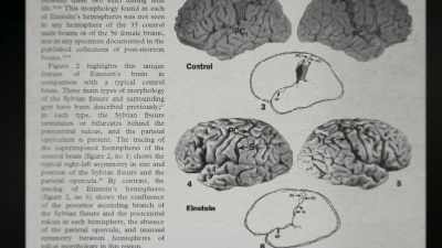 And, I'm gonna do her
a disservice, - The Man Who Stole Einstein's Brain