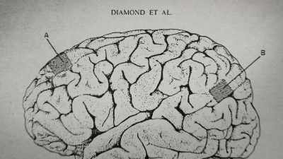 And in fact, a lot of people
used her study as an example - The Man Who Stole Einstein's Brain