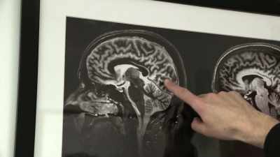 And this is a kind of spine to the cortex, - Magic Medicine