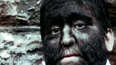 AND IT'S OFTEN KNOWN AS
THE WEREWOLF SYNDROME. - Strange Evidence