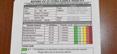 And on this particular patient,
the average was 93% inhibition, - Root Cause