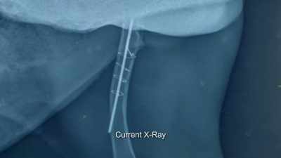 And that pin looks like it's
moved, through the bone itself. - Secrets of the Zoo