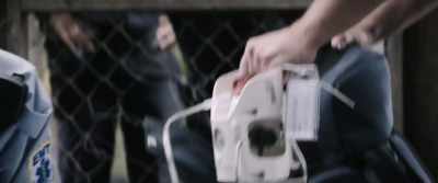 And right or wrong, the doctors didn't
want to risk taking it out. - Dogman
