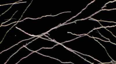 And somehow, that's more real
after a mystical experience. - Fantastic Fungi