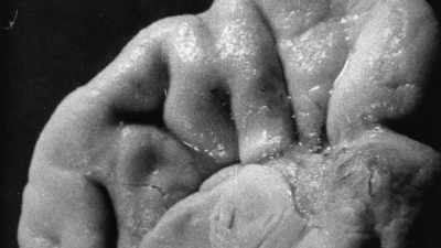 And that's how different
this one particular fissure - The Man Who Stole Einstein's Brain
