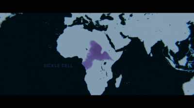 -And that's why you see
sickle cell anemia - Human Nature