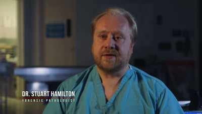 And so the pathologist
in the Nilsen case - Britain’s Most Evil Killers