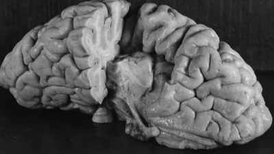 And there it was!
Einstein's brain! - The Man Who Stole Einstein's Brain