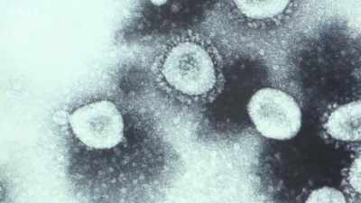 And these are common cold viruses. - Secrets of Size: Atoms to Supergalaxies