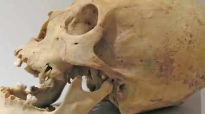 And they had many strange
anatomic anomalies, - Alien Worlds: Giants and Hybrids