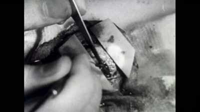 And what they found after the
operation was that the seizures - The Divided Brain