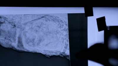 And what we're looking at is
the lower leg bone and the - Pompeii: Secrets of the Dead