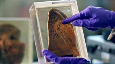And this would have led to bacteria
going to the bloodstream, - Tutankhamun: Secrets of the Tomb