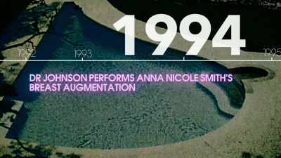 - Anna Nicole, she got
a lot of recognition, - Explant