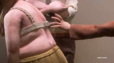 Announcer: The welt
that developed on her back - The Shivering Truth