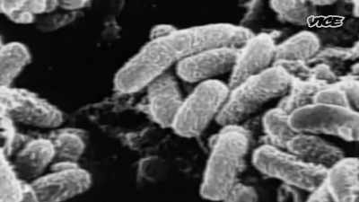 Anthrax is a highly infectious
and deadly disease - While The Rest Of Us Die