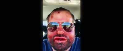 As you can see,
my lips are severely swollen. - Monster Inside: America's Most Extreme Haunted House