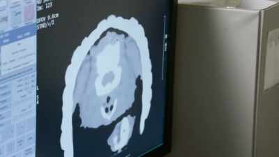 As doctor junge is taking the
ct, he was able to diagnose
him within seconds, - Secrets of the Zoo