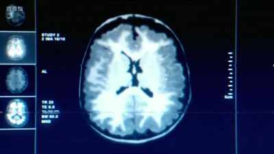 As we grow, our brain networks - The Human Body: Secrets of Your Life Revealed