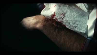 [bandage peels slimily] - A Most Atrocious Thing