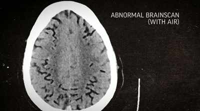 Based on the
scans, experts conclude - The Lesson Is Murder