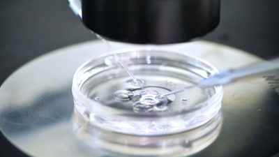 [Bayrak] So, you have an embryo
that has developed - Bill Nye Saves the World