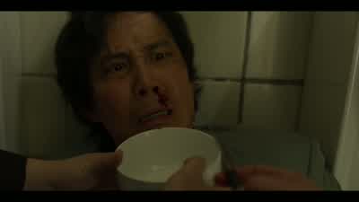 Because there are so many capillaries. - Squid Game
