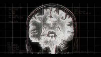 Believe you me,
when the brain loses its oxygen, - Surviving Death