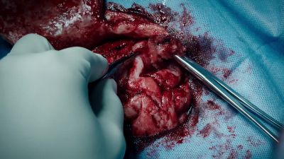 BELL:
Dr. Cain. - The Resident