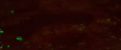 [bell rings] - Dark Match
