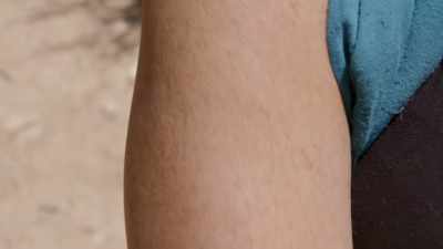 -Below that top layer of skin
is another one... - Human: The World Within