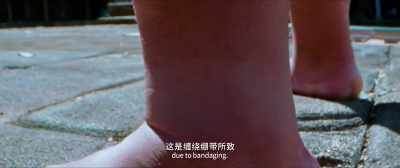 Besides, the skin tone of his left ankle - Detective Chinatown 3