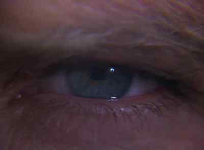 (BIONIC EYE SOUND EFFECT) - The Six Million Dollar Man