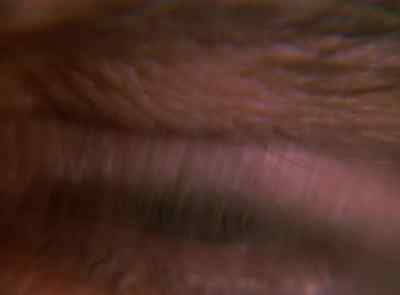 (BIONIC EYE SOUND EFFECT) - The Six Million Dollar Man