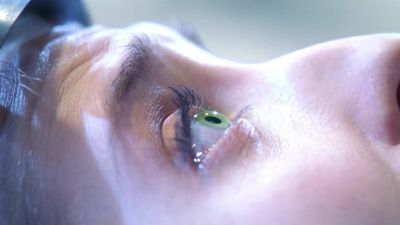 Blood iron levels? - Smallville