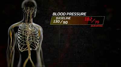 - Blood pressure's
a little elevated, 182/79. - Kings of Pain