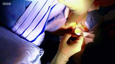 Both Sat and Tim know that in
procedures like Theresa's, - Surgeons: At the Edge of Life