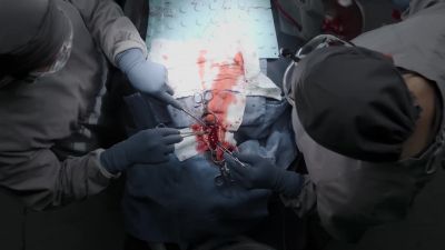 BP's 61 over 42. - The Good Doctor