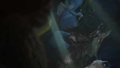 Brachial artery's retracted - 9-1-1