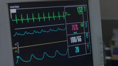 (Brett) Heart rate normalizing. - Chicago Fire