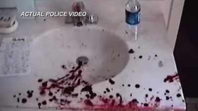 Bromage: FORENSIC PATHOLOGISTS
AT THE MEDICAL UNIVERSITY - Hometown Homicide