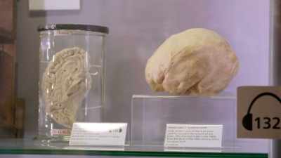 But here we've got an
interesting specimen. - The Divided Brain