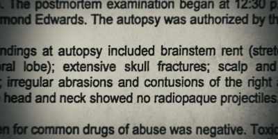 But his injuries pertain
to his head area. - Low Country: The Murdaugh Dynasty