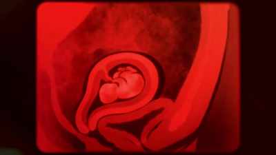 But this is what happens
when the egg is fertilised. - Good Sex