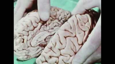 But that really, what went
on in the right hemisphere - The Divided Brain
