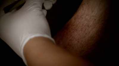 But then the irritation,
the itchiness, - Kings of Pain