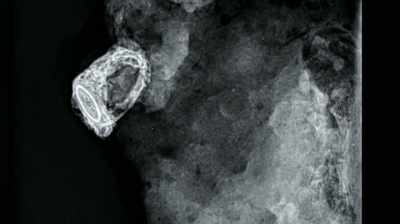 But, there is a
gemstone set into it, - Pompeii: Secrets of the Dead