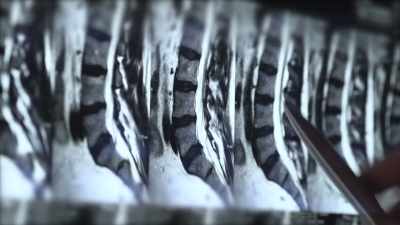 But when that pain is caused
by a pinched nerve, - Human: The World Within